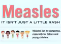 1st Positive Measles Case Reported In Tennessee Since 2019