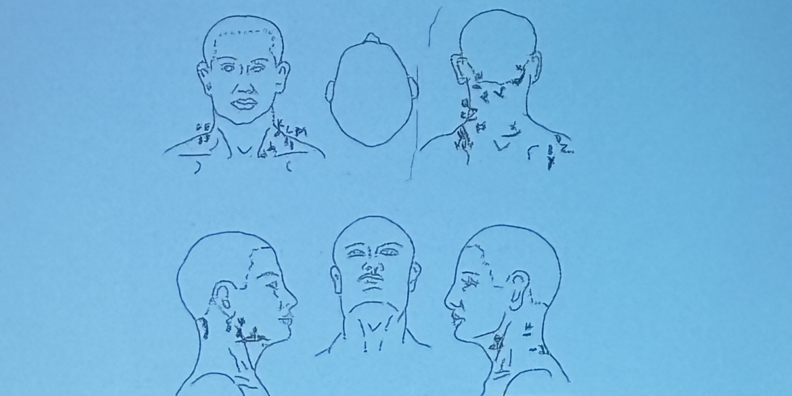 The sketch from Forensic Pathologist Dr. Nicol Masian shows the location of  twenty-six wounds which contributed to the death of Christopher Scott Short.