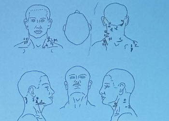 The sketch from Forensic Pathologist Dr. Nicol Masian shows the location of  twenty-six wounds which contributed to the death of Christopher Scott Short.